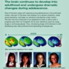 NIDA &gt; Time Lapse Study Brain Development