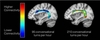 Adult-child conversations strengthen language regions of developing brain [sciencedaily.com]